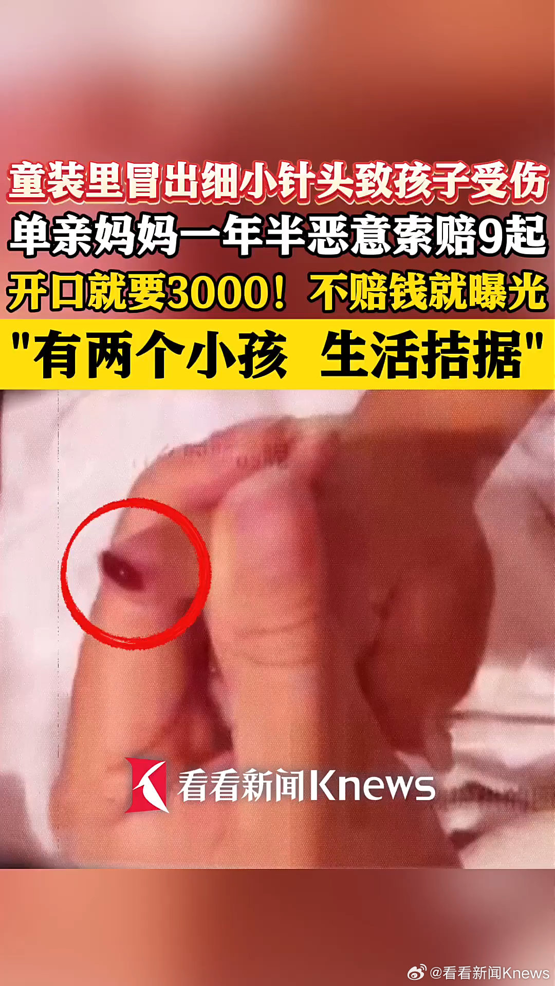赛事前瞻 - 爱游戏5
